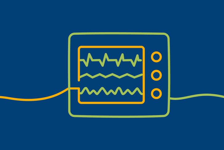 Illustration eines Monitors mit Vitalwerten als orange-grüne Bändergrafik auf blauem Hintergrund für das Informationsangebot für Zuweisende zur altersmedizinischen Akutstation im Albertinen Zentrum für Altersmedizin in Hamburg.